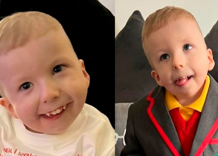 Niño padece una extraña enfermedad y hasta el agua podría matarlo.