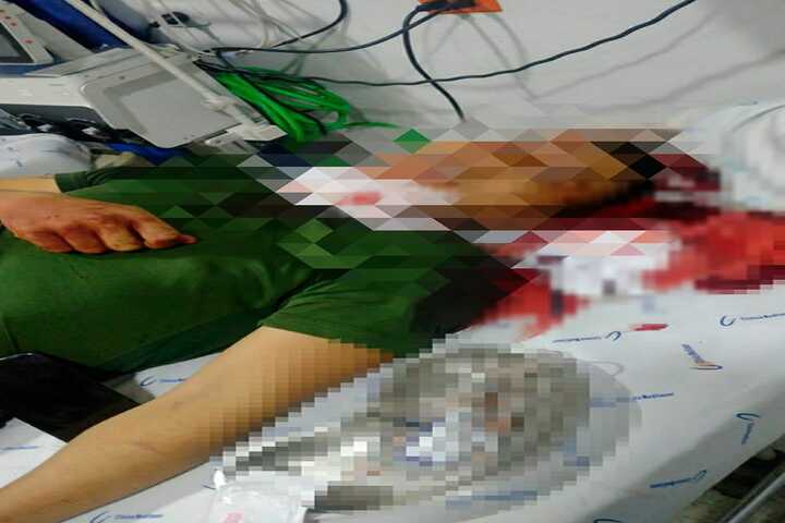 Policía agredido por una persona en estado de embriaguez