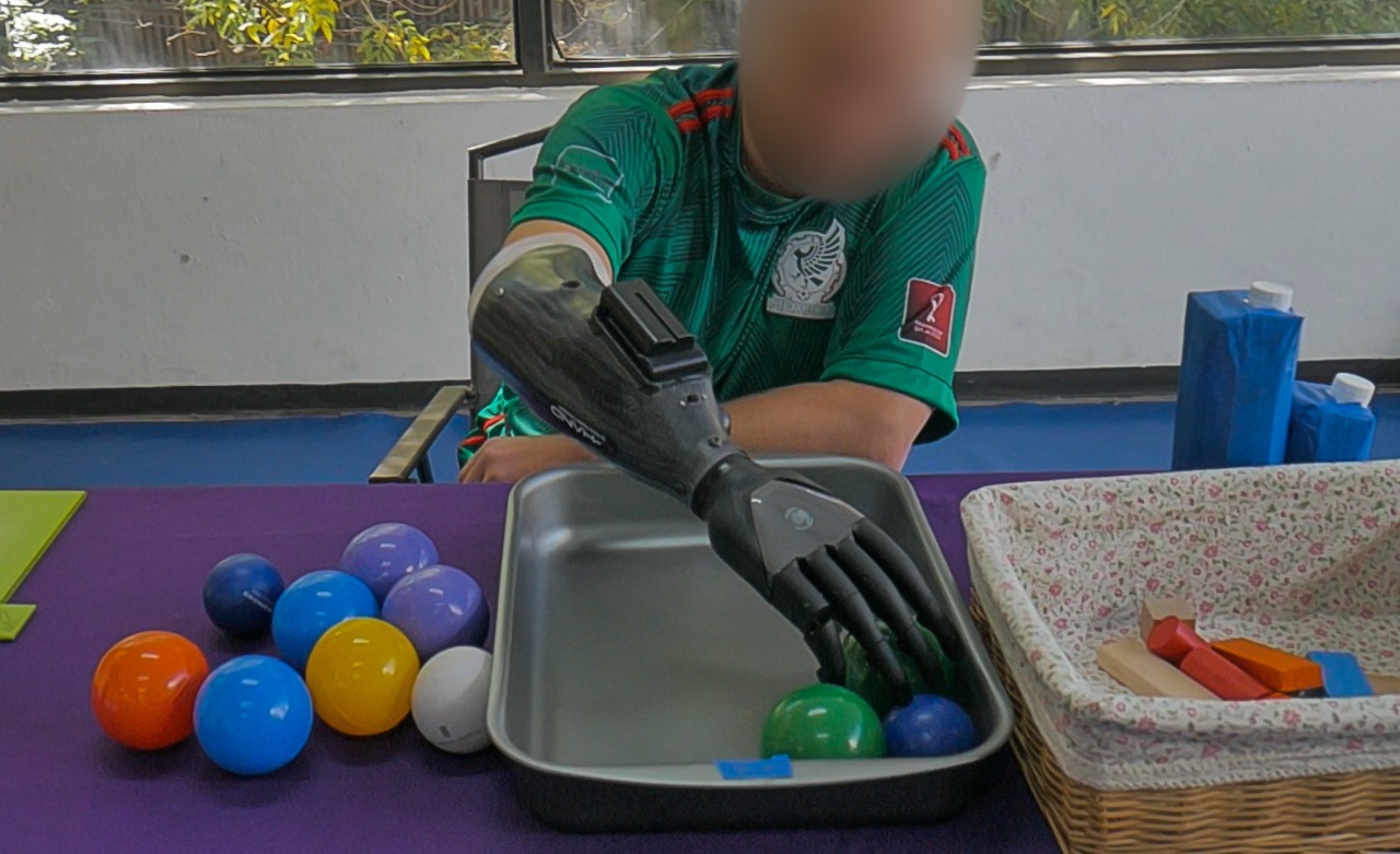 En Caquetá se elaboraran prótesis biónicas.