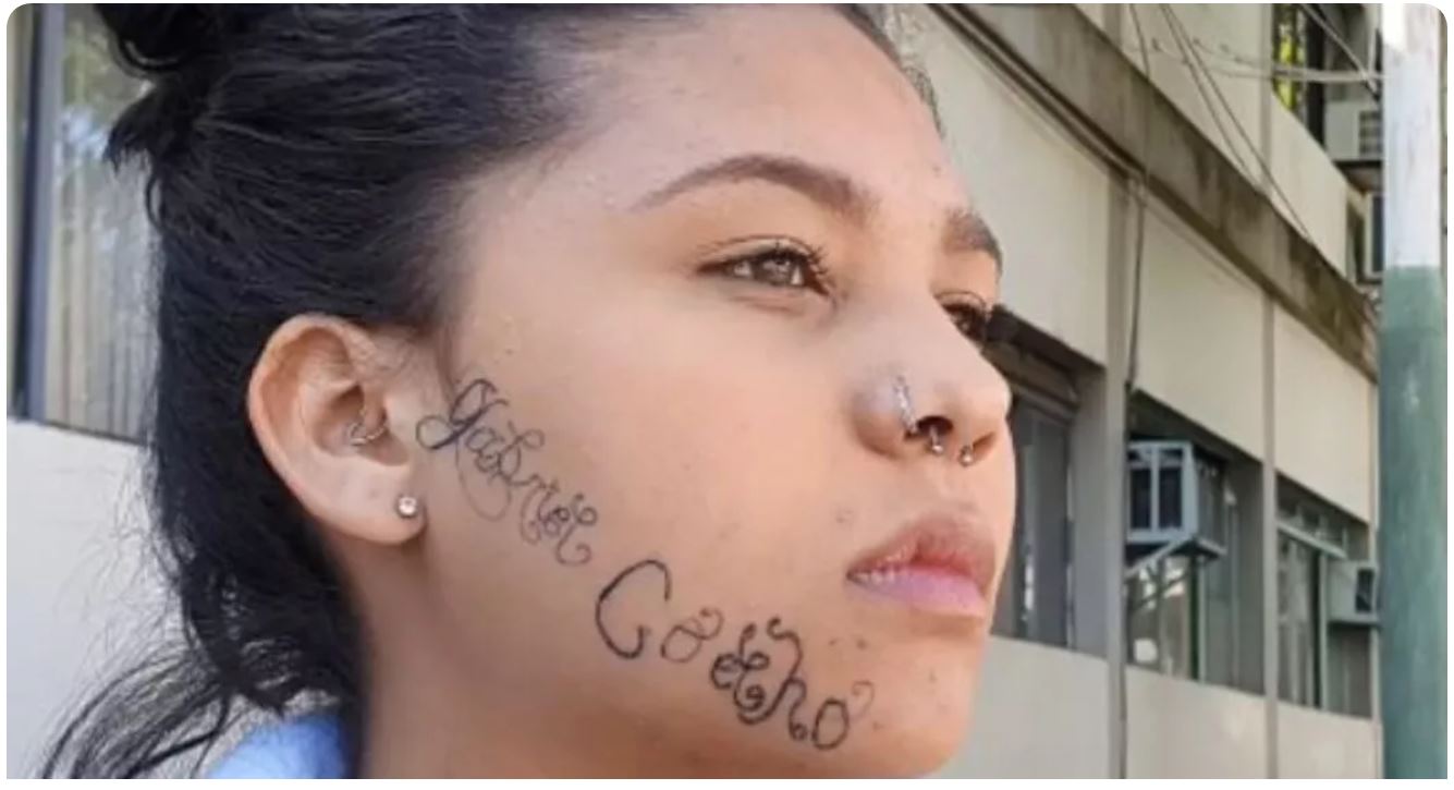 Mujer dijo que exnovio le marcó la cara con su nombre; él no aceptó que le terminara