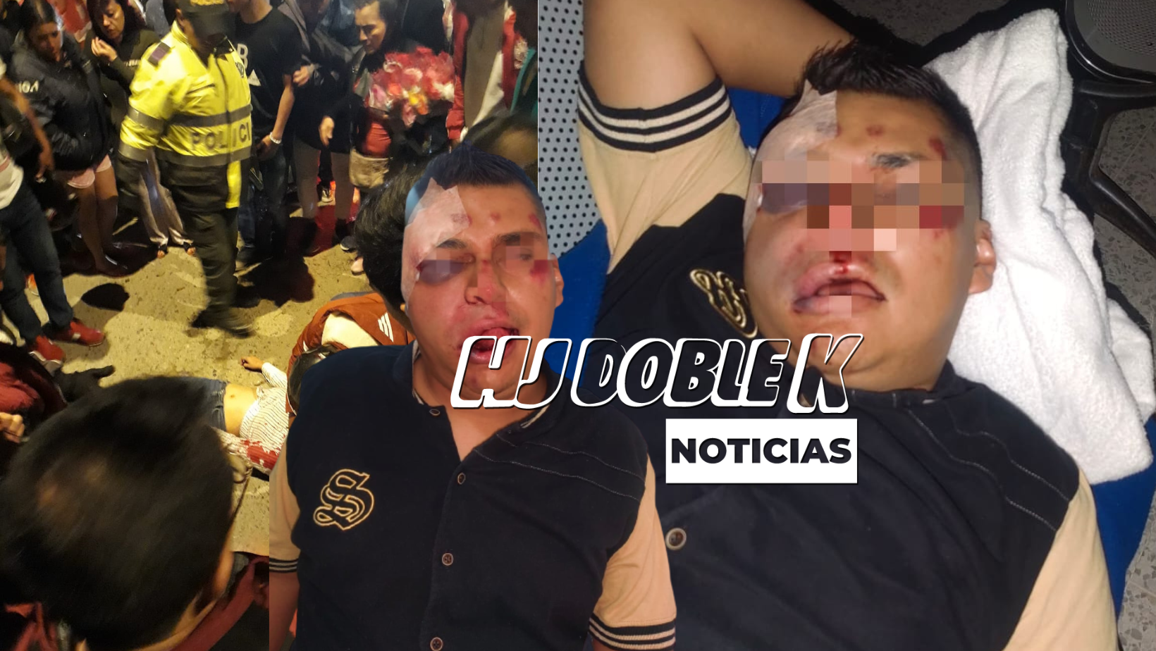 Accidente deja a un hombre con graves consecuencias.