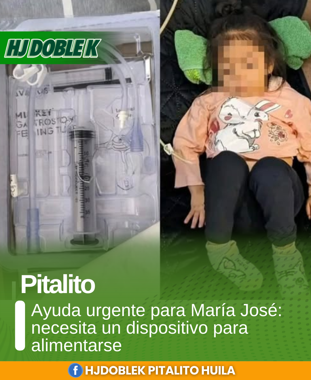 Ayuda urgente para María José: necesita un dispositivo para alimentarse.