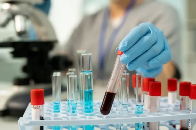 Fue ocultada contingencia en laboratorio de la Ese Carmen Emilia Ospina