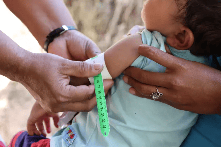 Confirman la muerte de un bebé por desnutrición en Aipe, Huila