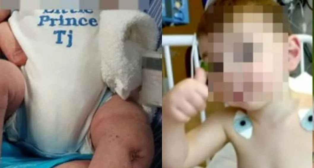 Un niño perdió sus piernas por culpa de su padre