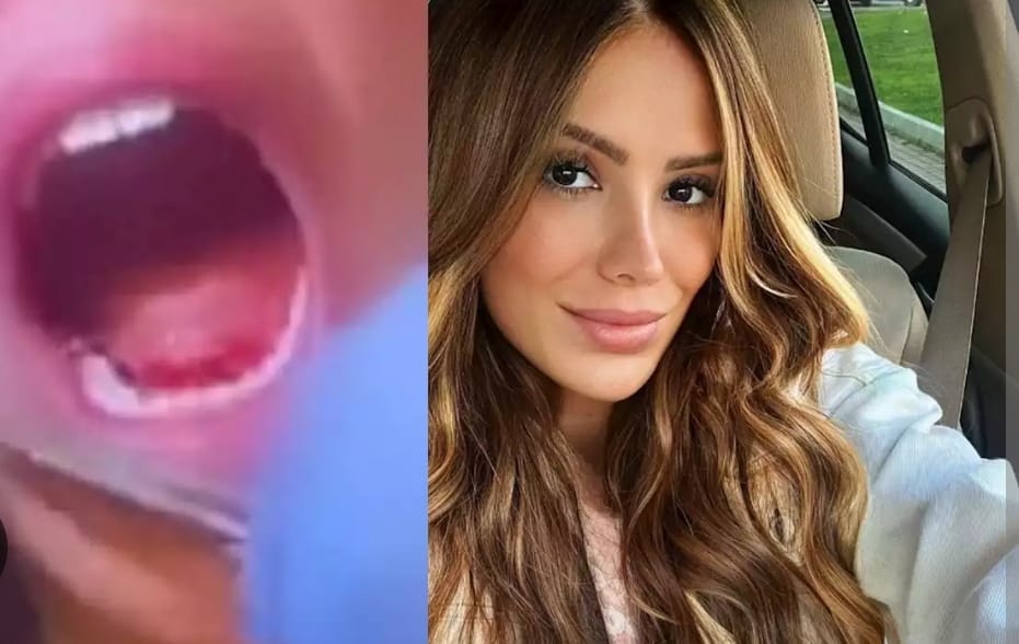 BUSCAR Pulzo      Mujer terminó su cita romántica en hospital por el fuerte beso de su acompañante