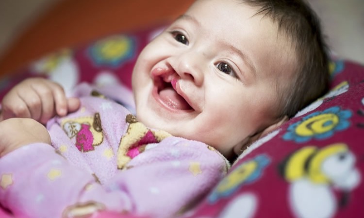 Vuelve ´Sonrisas de Vida´ al Caquetá.