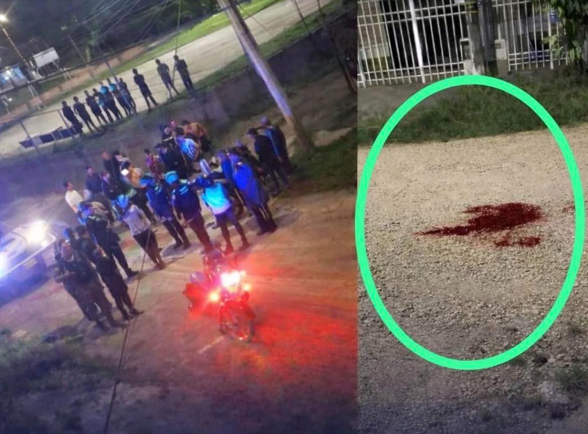 Ataque sicarial en Pitalito deja una persona gravemente herida