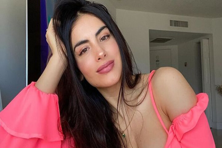 LA PRESENTADORA Y MODELO JESSICA CEDIEL, MOSTRO SUS CICATRICES
