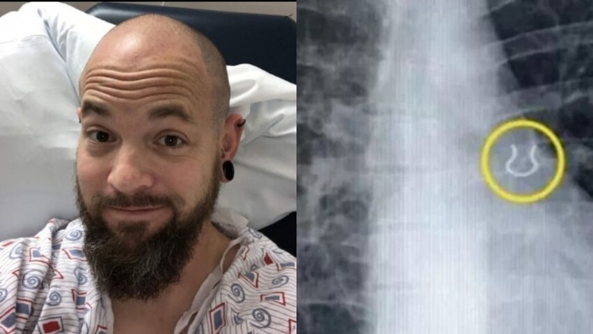 Se le desapareció el piercing