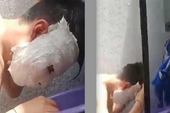 Estudiante se hizo una máscara de yeso para una tarea y se le quedó pegada