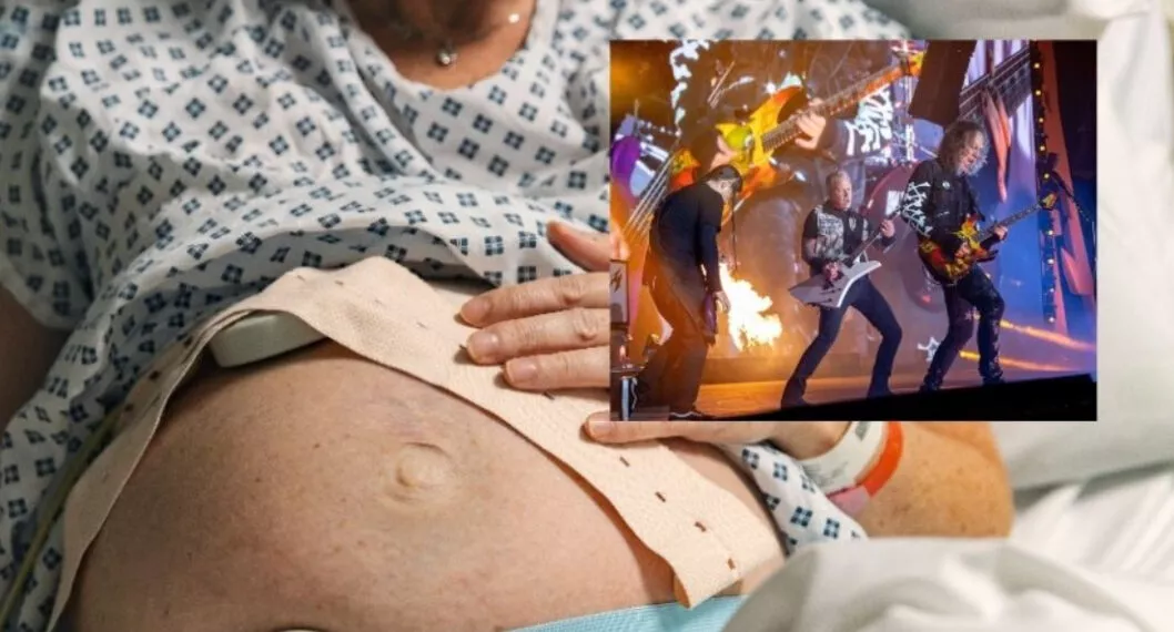 Mujer dio a luz a bebé en concierto de Metallica; dicen que lleva el 'rock' en las venas