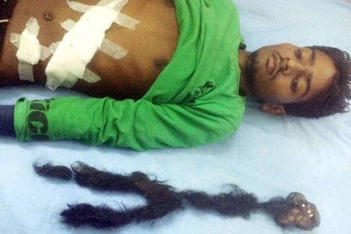 Increíble: comenzó a sentir dolor de estómago y los médicos hallaron algo misterioso