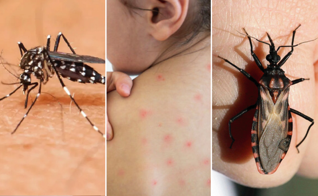 ¡Atención! Los casos de Dengue aumentan en el Huila