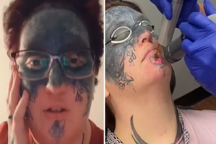 Insólito a una mujer le tatuaron el rostro en contra de su voluntad