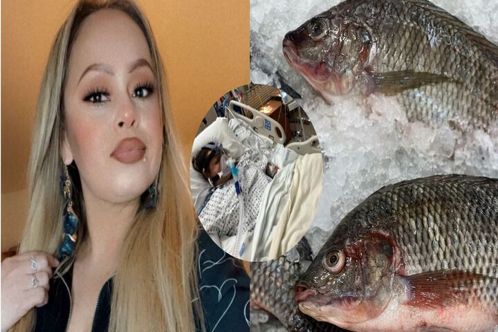 Una mujer perdió sus cuatro extremidades luego de que comiera pescado