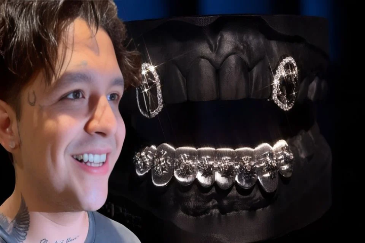 Christian Nodal estrena lujosa dentadura