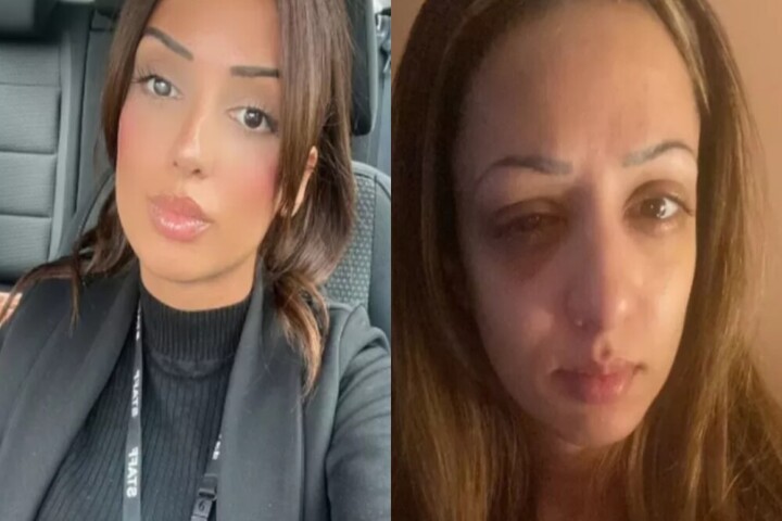 Una Mujer perdió la visión por nadar en una piscina