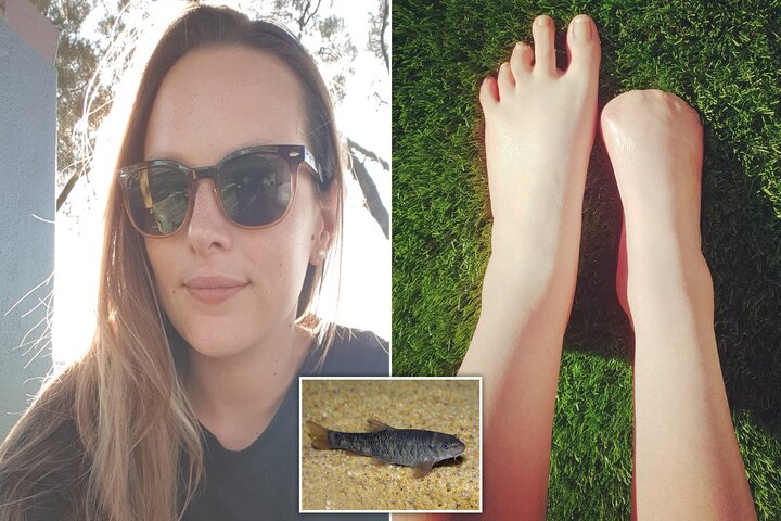 Se realizó una exfoliación con peces y se quedo sin dedos