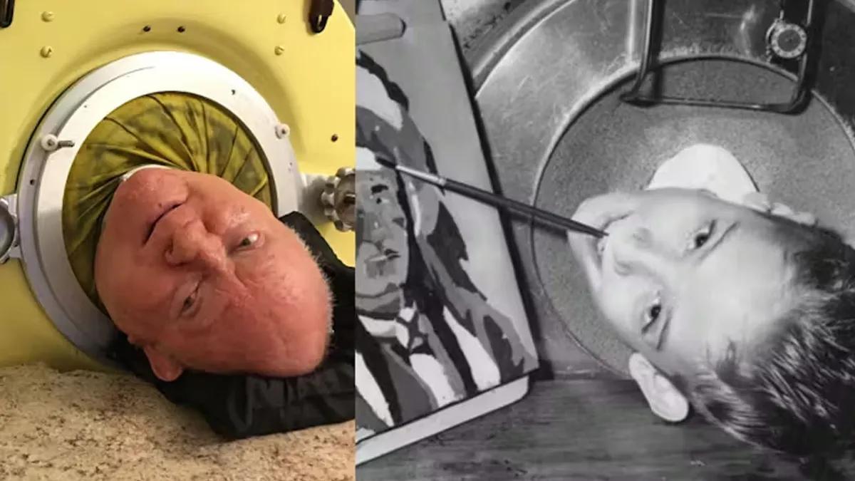 A los 78 años muere “el hombre del pulmón de acero”