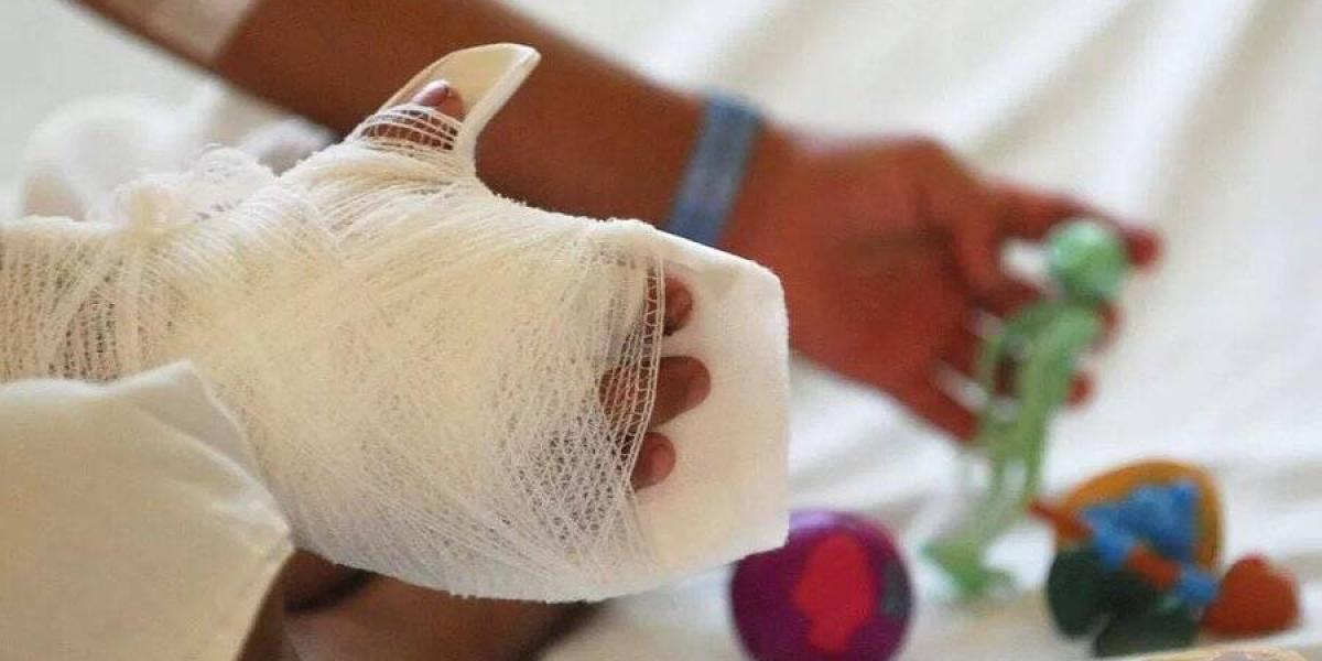 [AUDIO] Confirman 4 personas quemadas por el uso de pólvora en el Huila