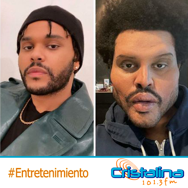 CAMBIO EXTRENO EN EL ROSTRO DEL ARTISTA CANADIENSE THE WEEKND
