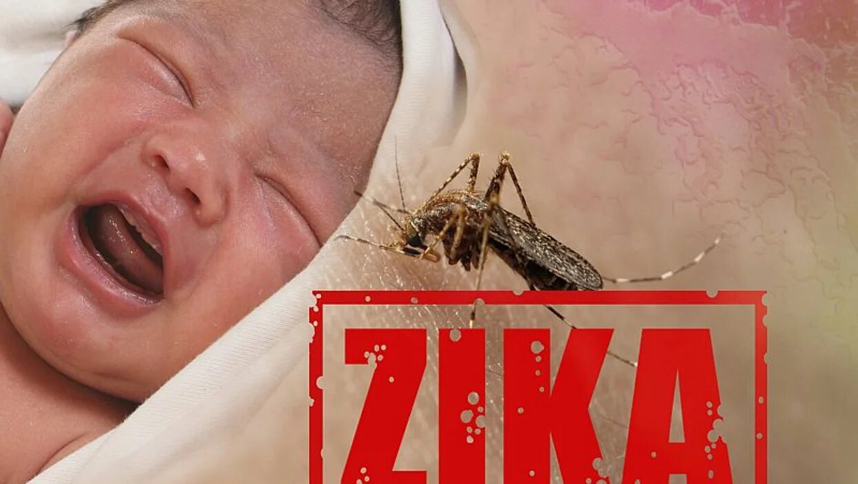 [AUDIO] Bebés con desórdenes causados por el virus del Zika